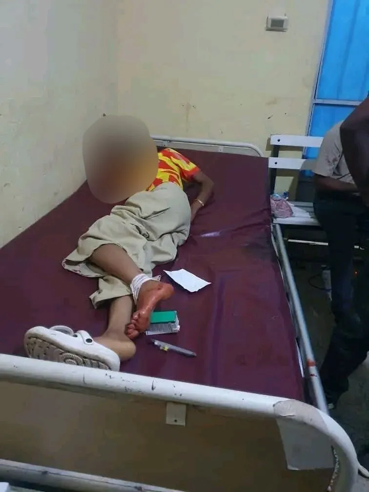 በሽረ እንዳስላሴ በመዝናኛ ስፍራ ላይ በተወረወረ የእጅ ቦንብ ምክንያት በ17 ሰዎች ላይ ቀላል እና ከባድ የአካል ጉዳት ደረሰ