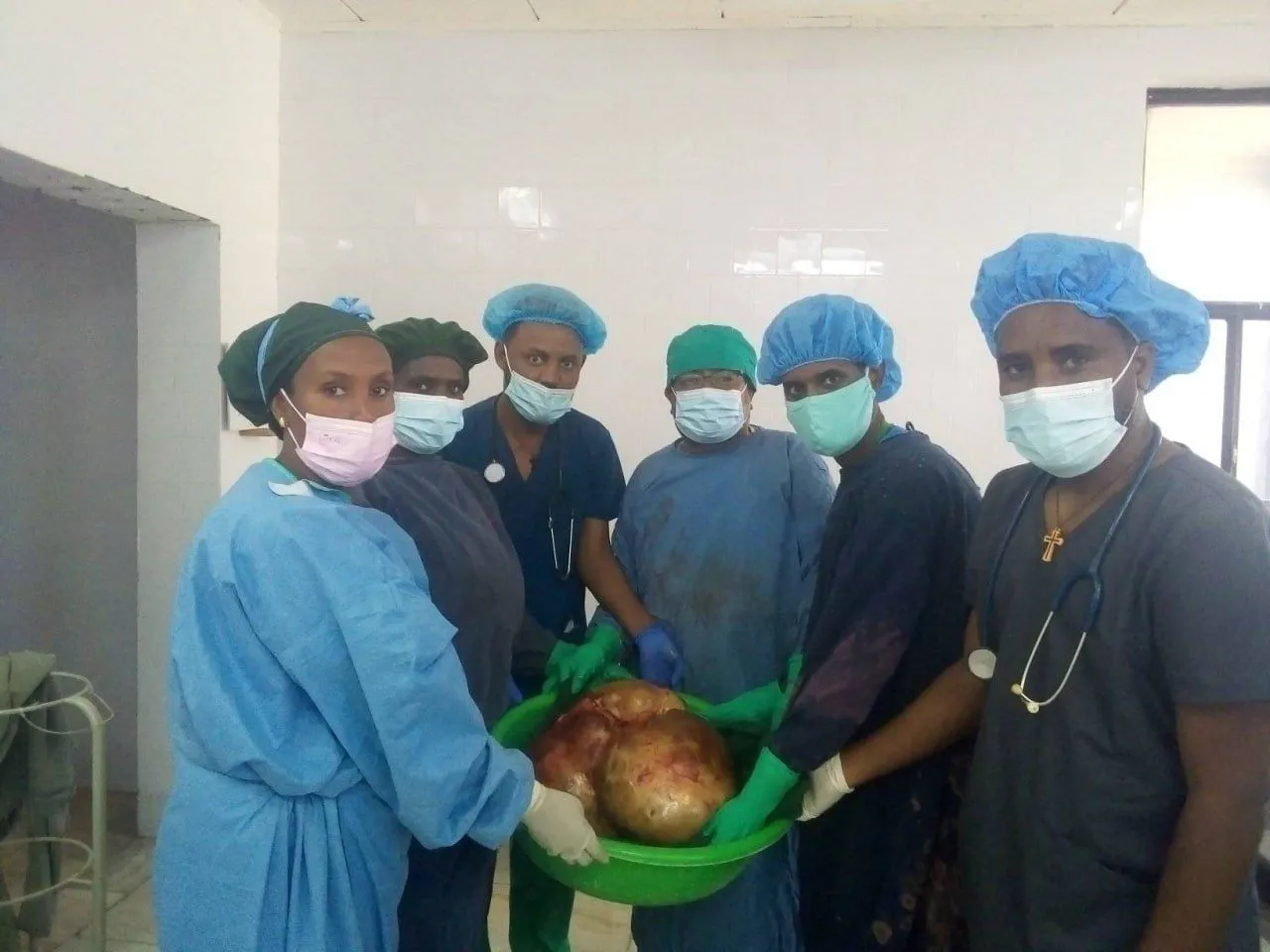 ከአንዲት እናት 20 ነጥብ 6 ኪሎ ግራም የሚመዝን ዕጢ ተወገደ